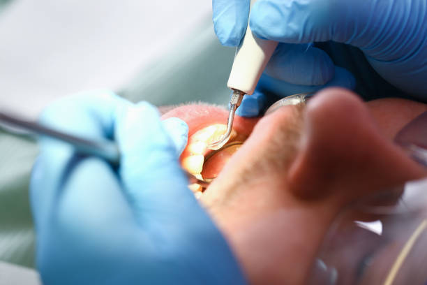 Best Emergency Cosmetic Dentistry (e.g., broken veneers) in Lavonia, GA