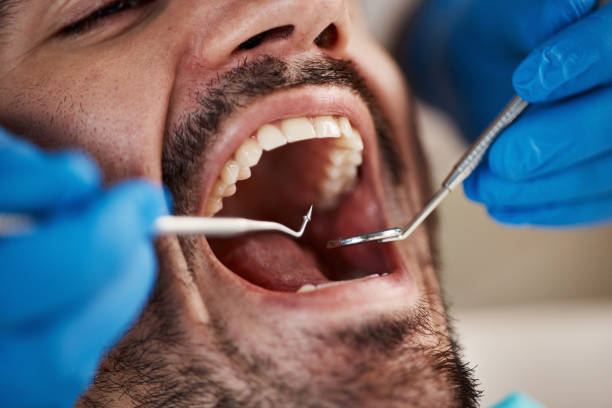 Best Emergency Treatment for Jaw Pain or Injury in Lavonia, GA