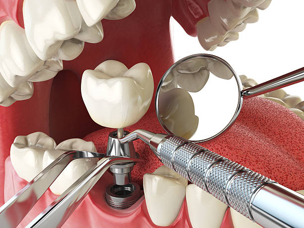 Best Emergency Denture Repair in Lavonia, GA